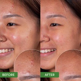 Oil Control - Clearing Face Mask