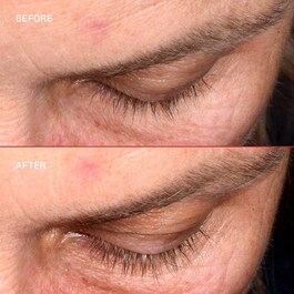 Lashbond™ - Ορός Βλεφαρίδων