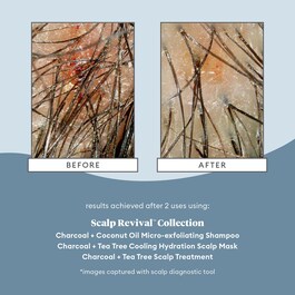 Scalp Revival™ Charcoal + Tea Tree Scalp Treatment