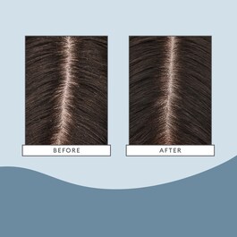 SCALP REVIVAL CHARCOAL TEA TREE MASK