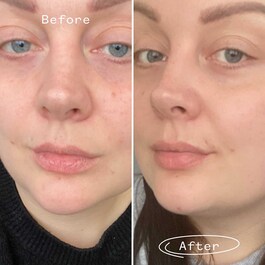 Rosehip Bioregenerate Universal Face Oil