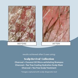 Scalp Revival™ Charcoal + Tea Tree Scalp Treatment