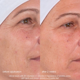 Dynamic Skin Retinol Serum - Anti-Wrinkles Serum