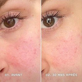 Evercalm™ - Redness Relief Serum