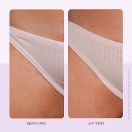 Ingrown Hair Pads - Δίσκοι για τρίχες που γυρίζουν προς τα μέσα x60 
