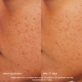 Daily Microfoliant Exfoliator