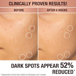 Dark Spot Correcting Radiance Recovery Serum - Ορός Κατά των Κηλίδων