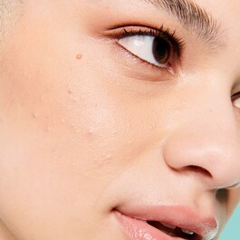 The POREfessional – Benefit primer για την μείωση των πόρων