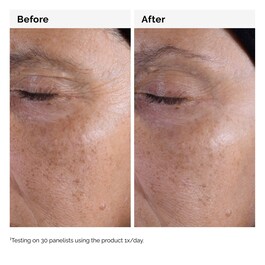 Glycolic Acid 7% Toning Solution