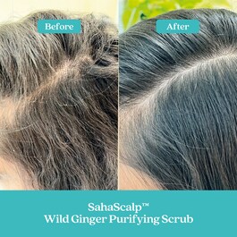 SahaScalp™ - Wild Ginger Purifying Scrub