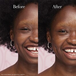 Rose Face Cream - Ενυδατική κρέμα προσώπου με υαλουρονικό οξύ