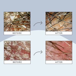 Scalp Revival™ Soothing Solutions Value Set for Oily, Itchy + Dry Scalp
