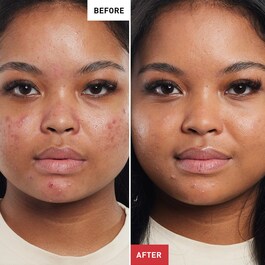 SUPER BB WITH GINSENG CLAIR - High covering Anti-imperfections care