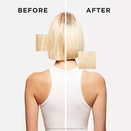 Blond Absolu 2% Pure Hyaluronic Acid Ορός Για Το Τριχωτό & Τα Μαλλιά