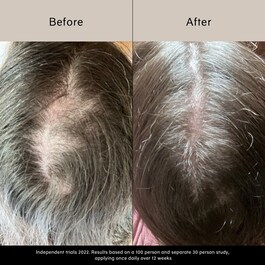 Pitta Growth Serum - Ορός ανάπτυξης
