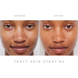 Start'r Set - Revamp