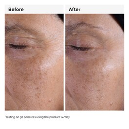 Glycolic Acid 7% Toning Solution