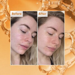 Ready Steady Glow Daily AHA Tonic
