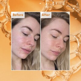 Ready Steady Glow Daily AHA Tonic