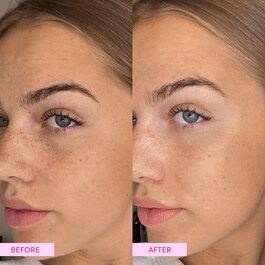 Australian Emu Apple - Radiance Serum
