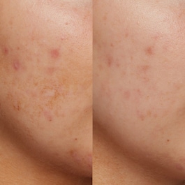 B3 Nice 10% Niacinamide - Radiance Serum