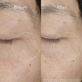 Tea Elixir Skin Resilience Activating Serum - Ορός ενεργοποίησης ανθεκτικότητας
