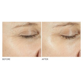 Advanced Retinol + Ferulic - Ορός Περιγράμματος Ματιών Τριπλής Διόρθωσης