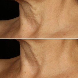 Smart Clinical Repair Lifting Face + Neck Cream 