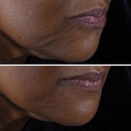 Smart Clinical Repair Lifting Face + Neck Cream 