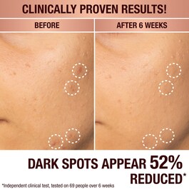 Dark Spot Correcting Radiance Recovery Serum - Ορός Κατά των Κηλίδων