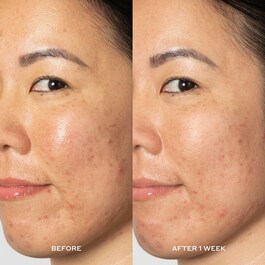 Glow2OH Dark Spot Toner AHAs Dark Spot Toner