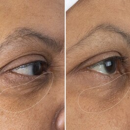 The Eye Cream