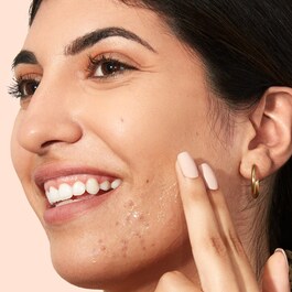 Acne Serum - Acne Clarifying Treatment