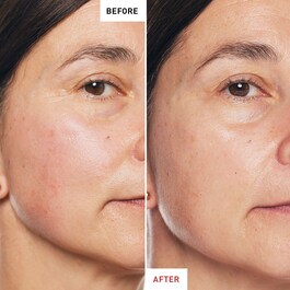 Skin Therapy  - Multi-Perfecting Night Oil