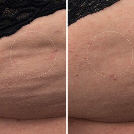 The Body Cream - Body care