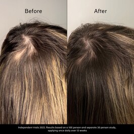 Pitta Growth Serum - Ορός ανάπτυξης