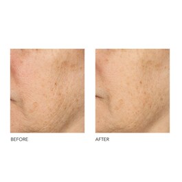 Alpha Beta® - Universal Daily Peel