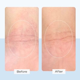 ULTRA REPAIR CREAM