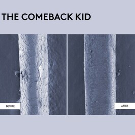 The Comeback Kid: Θεραπεία Άμεσης Επανόρθωσης