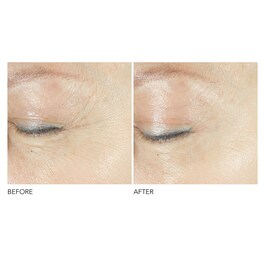 Advanced Retinol + Ferulic - Ορός Περιγράμματος Ματιών Τριπλής Διόρθωσης