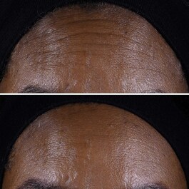 Smart Clinical Repair Lifting Face + Neck Cream 