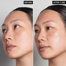 Hyaluronic Acid - Serum