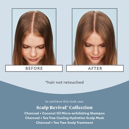 Scalp Revival™ Charcoal + Tea Tree Scalp Treatment