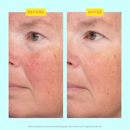 C-Luma™ Hydrabright Serum - Ορός με βιταμίνη C