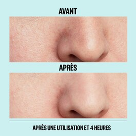 Peace Out Pores - Patches for Pores and Blackheads