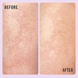 DAILY ESSENTIALS KP BODY SCRUB 10% AHA