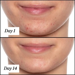 U.F.O. Ultra-Clarifying Face Oil