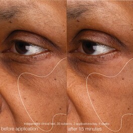 Biolumin-C Gel  Moisturizer